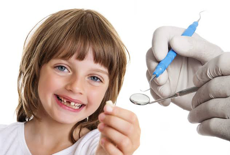 Milk Teeth Extraction in Visakhapatnam Best Destist in Vizag