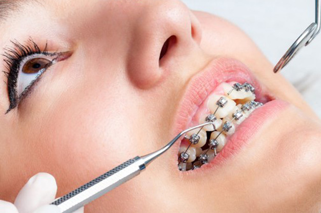 Best Orthodontic Treatment in Vizag Best Orthodontic Treatment in Vizag