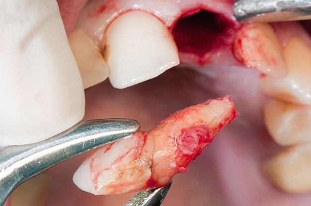 Best Dental Surgeon in Vizag Best Dental Surgeon in Vizag