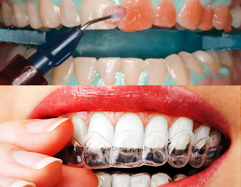 Cosmetic Dental Clinic in Visakhapatnam Cosmetic Dental Clinic in Visakhapatnam